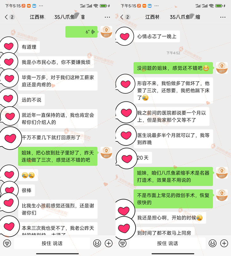 八爪魚陰道緊縮術(shù)的效果如何?縮陰術(shù)幫助解決陰道鬆弛問題